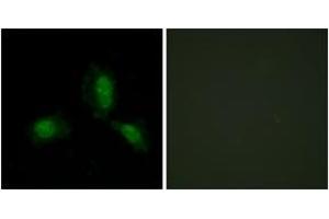 Immunofluorescence analysis of HeLa cells, using IRS-1 (Ab-312) Antibody. (IRS1 抗体  (AA 279-328))