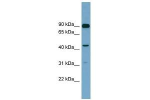 DGKA antibody used at 1 ug/ml to detect target protein. (DGKA 抗体  (N-Term))