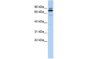 WB Suggested Anti-C14orf21 Antibody Titration:  0. (C14orf21 抗体  (Middle Region))