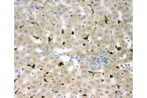 Immunohistochemistry (IHC) image for anti-CD68 Molecule (CD68) (AA 312-326), (Middle Region) antibody (ABIN3044428)