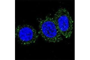 Confocal immunofluorescent analysis of anti-AKT2 antibody with HeLa cells followed by Alexa Fluor 488-conjugated goat anti-mouse lgG (green). (AKT2 抗体)