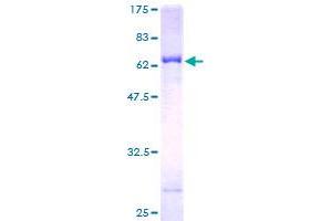 Image no. 1 for Nuclear Receptor Subfamily 2, Group E, Member 3 (NR2E3) (AA 1-322) protein (GST tag) (ABIN1312960) (NR2E3 Protein (AA 1-322) (GST tag))