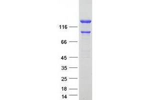 INF2 Protein (Transcript Variant 1) (Myc-DYKDDDDK Tag)