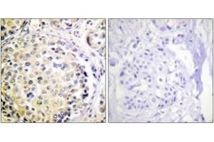 Immunohistochemistry (IHC) image for anti-Vimentin (VIM) (AA 31-80) antibody (ABIN2888938) (Vimentin 抗体  (AA 31-80))