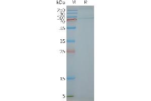 Human FSHR-Nanodisc, Flag Tag on SDS-PAGE (FSHR 蛋白)