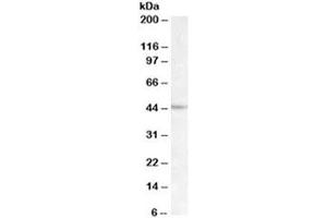 Western blot testing of Daudi lysate with LHX2 antibody at 1ug/ml. (LHX2 抗体)