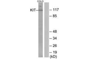 Western Blotting (WB) image for anti-Mast/stem Cell Growth Factor Receptor (KIT) (AA 906-955) antibody (ABIN2888670) (KIT 抗体  (AA 906-955))