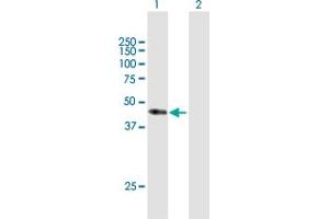 Western Blot analysis of CD34 expression in transfected 293T cell line by CD34 MaxPab polyclonal antibody. (CD34 抗体  (AA 1-373))