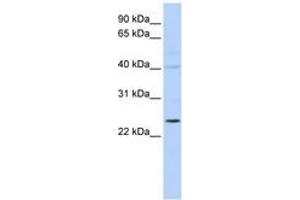 Image no. 1 for anti-Kv Channel Interacting Protein 2 (KCNIP2) (N-Term) antibody (ABIN6742581) (KCNIP2 抗体  (N-Term))