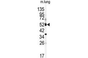 Image no. 1 for anti-Cytochrome P450, Family 1, Subfamily A, Polypeptide 1 (CYP1A1) (C-Term) antibody (ABIN360414) (CYP1A1 抗体  (C-Term))