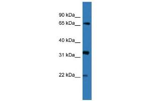 Western Blot showing DOK4 antibody used at a concentration of 1-2 ug/ml to detect its target protein. (DOK4 抗体  (N-Term))