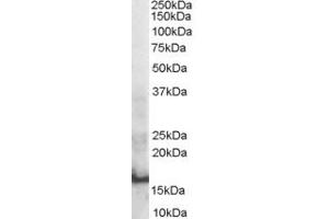 Western Blotting (WB) image for anti-SH2 Domain Containing 1A (SH2D1A) (Internal Region) antibody (ABIN2466265) (SH2D1A 抗体  (Internal Region))