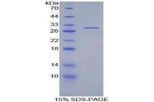 SDS-PAGE analysis of Human Torsin 3A Protein. (TOR3A 蛋白)