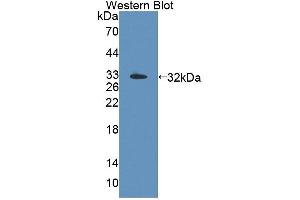 Western blot analysis of the recombinant protein. (TOP3B 抗体  (AA 1-250))