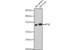 Western blot analysis of extracts of various cell lines using RPS6 Polyclonal Antibody at dilution of 1:1000. (RPS6 抗体)