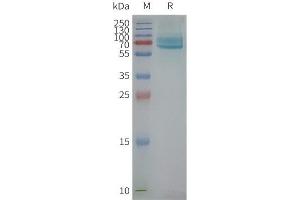 Human CD39-Nanodisc, Flag Tag on SDS-PAGE (CD39 蛋白)