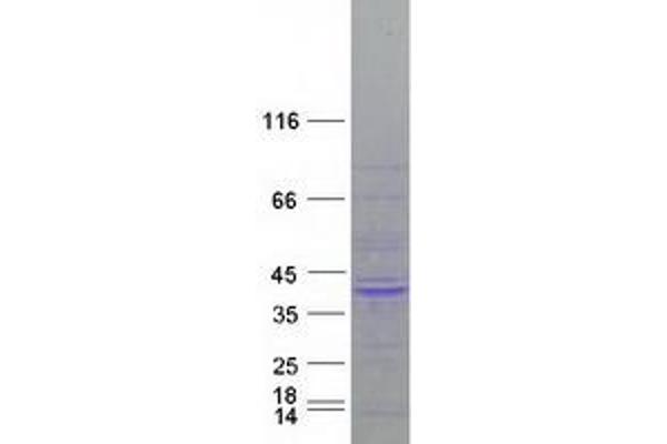 GPS2 Protein (Myc-DYKDDDDK Tag)