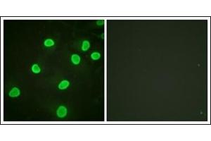 Immunofluorescence analysis of HeLa cells, using Histone H4 (Acetyl-Lys5) Antibody. (Histone H4 抗体  (acLys5))