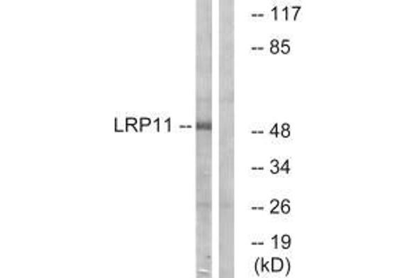 LRP11 抗体