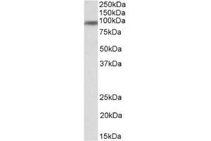 Staining of Human Breast lysate using CD71 / TFRC Antibody at 1 µg/ml (35µg protein in RIPA buffer). (Transferrin Receptor 抗体  (N-Term))