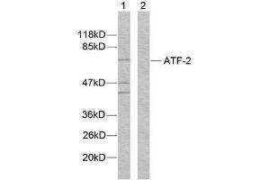 Western blot analysis of extracts from MDA-MB-435 cells using ATF-2 (Ab-112 or 94) antibody (E021033). (ATF2 抗体)