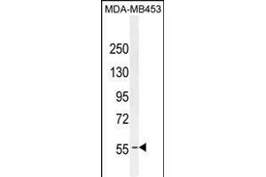 ESR1 antibody (ABIN659085 and ABIN2838074) western blot analysis in MDA-M cell line lysates (35 μg/lane). (Estrogen Receptor alpha 抗体)