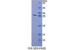 SDS-PAGE analysis of Human CHP Protein. (CHP 蛋白)