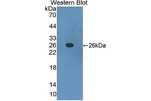 Western Blotting (WB) image for anti-Interferon alpha/beta Receptor 1 (IFNAR1) (AA 28-227) antibody (ABIN2118487) (IFNAR1 抗体  (AA 28-227))