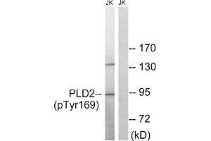 Western blot analysis of extracts from Jurkat cells treated with TNF using PLD2 (Phospho-Tyr169) Antibody. (Phospholipase D2 抗体  (pTyr169))