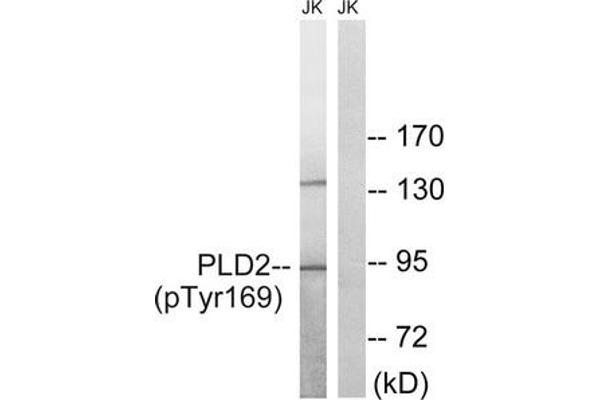 Phospholipase D2 抗体  (pTyr169)