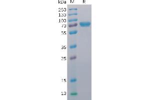 Human CD40 Protein, mFc-His Tag on SDS-PAGE under reducing condition. (CD40 Protein (CD40) (AA 21-193) (mFc-His Tag))