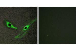 Peptide - +Immunohistochemistry analysis of paraffin-embedded human brain tissue, using ICK antibody. (ICK 抗体)