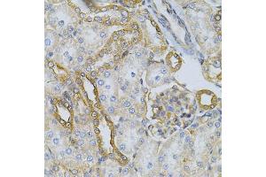Immunohistochemistry of paraffin-embedded rat kidney using HSP90AB1 Antibody (ABIN5970445) at dilution of 1/100 (40x lens). (HSP90AB1 抗体)