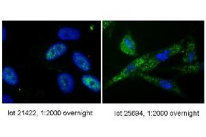 anti-hTERT antibody-Immunofluorescence. (TERT 抗体  (C-Term))