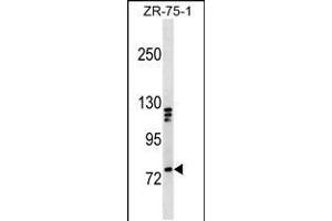 Western blot analysis in ZR-75-1 cell line lysates (35ug/lane). (KIF3A 抗体  (C-Term))