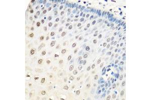 Immunohistochemistry of paraffin-embedded human esophagus using HNRNPA0 antibody. (HNRNPA0 抗体  (AA 1-180))