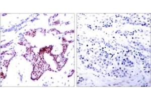Immunohistochemistry (IHC) image for anti-Nuclear Factor-kB p65 (NFkBP65) (pSer276) antibody (ABIN2888487) (NF-kB p65 抗体  (pSer276))