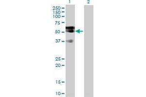 Western Blot analysis of LIPG expression in transfected 293T cell line by LIPG MaxPab polyclonal antibody. (LIPG 抗体  (AA 1-500))