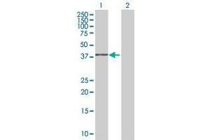 Lane 1: GMPR2 transfected lysate ( 38. (GMPR2 293T Cell Transient Overexpression Lysate(Denatured))