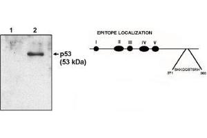 Image no. 1 for anti-Tumor Protein P53 (TP53) (AA 371-380) antibody (ABIN201677) (p53 抗体  (AA 371-380))