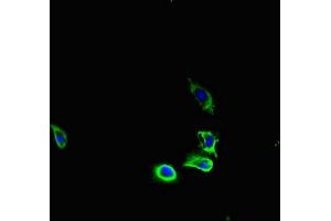 Immunofluorescent analysis of U251 cells using ABIN7163626 at dilution of 1:100 and Alexa Fluor 488-congugated AffiniPure Goat Anti-Rabbit IgG(H+L) (PDGFRA 抗体  (AA 30-198))