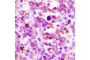 Immunohistochemical analysis of Claudin 2 staining in human tonsil formalin fixed paraffin embedded tissue section. (Claudin 2 抗体  (C-Term))