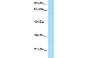 Western Blotting (WB) image for anti-Protein Phosphatase 2A 48 KDa Regulatory Subunit (PPP2R3B) (N-Term) antibody (ABIN2775378) (PPP2R3B 抗体  (N-Term))