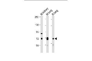 All lanes : Anti-DLL4 Antibody (C-Term) at 1:1000-1:2000 dilution Lane 1: Mouse kidney lysate Lane 2: Mouse lung lysate Lane 3: Rat lung lysate Lysates/proteins at 20 μg per lane. (DLL4 抗体  (AA 608-641))