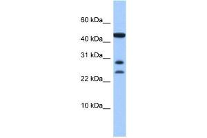 C20ORF141 antibody used at 1 ug/ml to detect target protein. (C20orf141 抗体  (Middle Region))