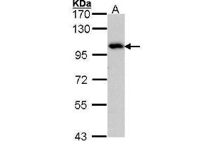 WB Image Sample (30 ug of whole cell lysate) A: Hep G2 , 7. (ADAM15 抗体  (N-Term))