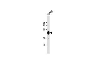 Anti-HIS Tag Antibody at 1:2000 dilution + 12-tag protein lysate Lysates/proteins at 20 μg per lane. (His 标记 抗体)