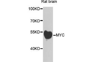 Western blot analysis of extracts of rat brain, using MYC antibody (ABIN5996012) at 1/500 dilution. (c-MYC 抗体)