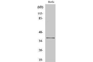 Western Blotting (WB) image for anti-Cyclin H (CCNH) (Ser212) antibody (ABIN3179986) (Cyclin H 抗体  (Ser212))