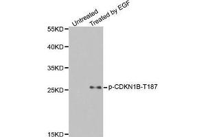 Western Blotting (WB) image for anti-Cyclin-Dependent Kinase Inhibitor 1B (p27, Kip1) (CDKN1B) (pThr187) antibody (ABIN3020148) (CDKN1B 抗体  (pThr187))